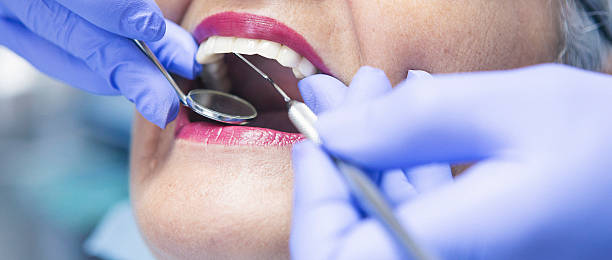 Best Emergency Tooth Extraction in Washington, MO